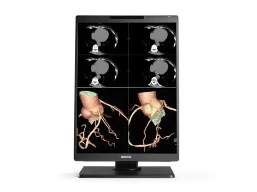 MDNC-x521-front-no-cover-ColorCT-onwhite_preview-jpg.webp
